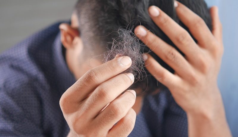 homme triste qui tient une poignée de cheveux